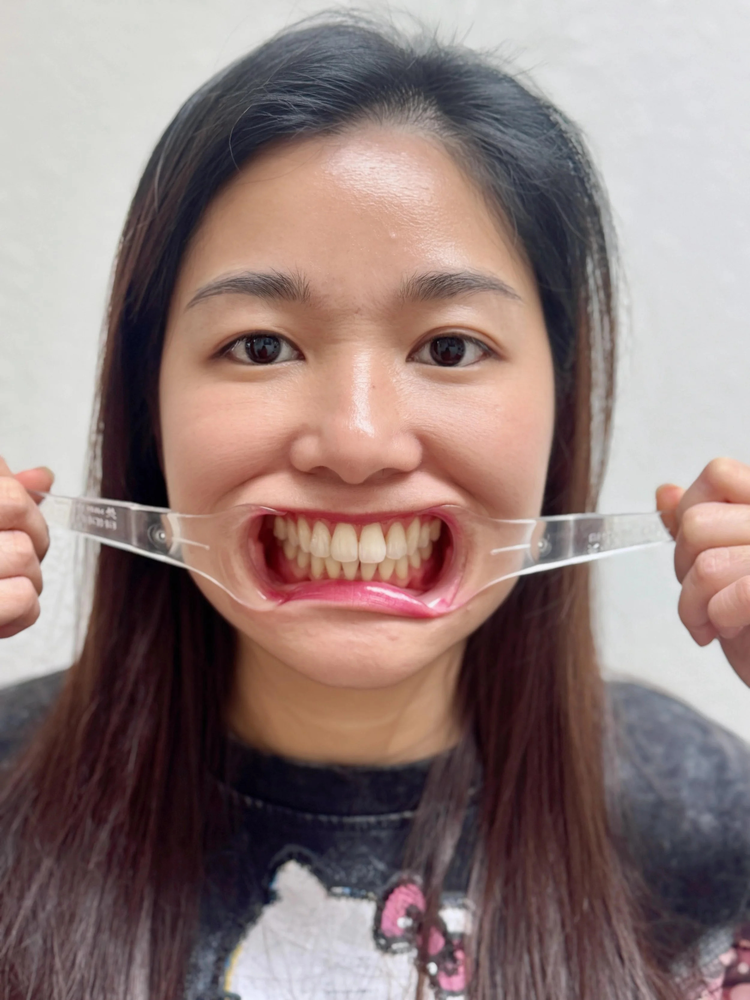 Diagnostic Treatment Services — 38 Smiles Dental Laboratory